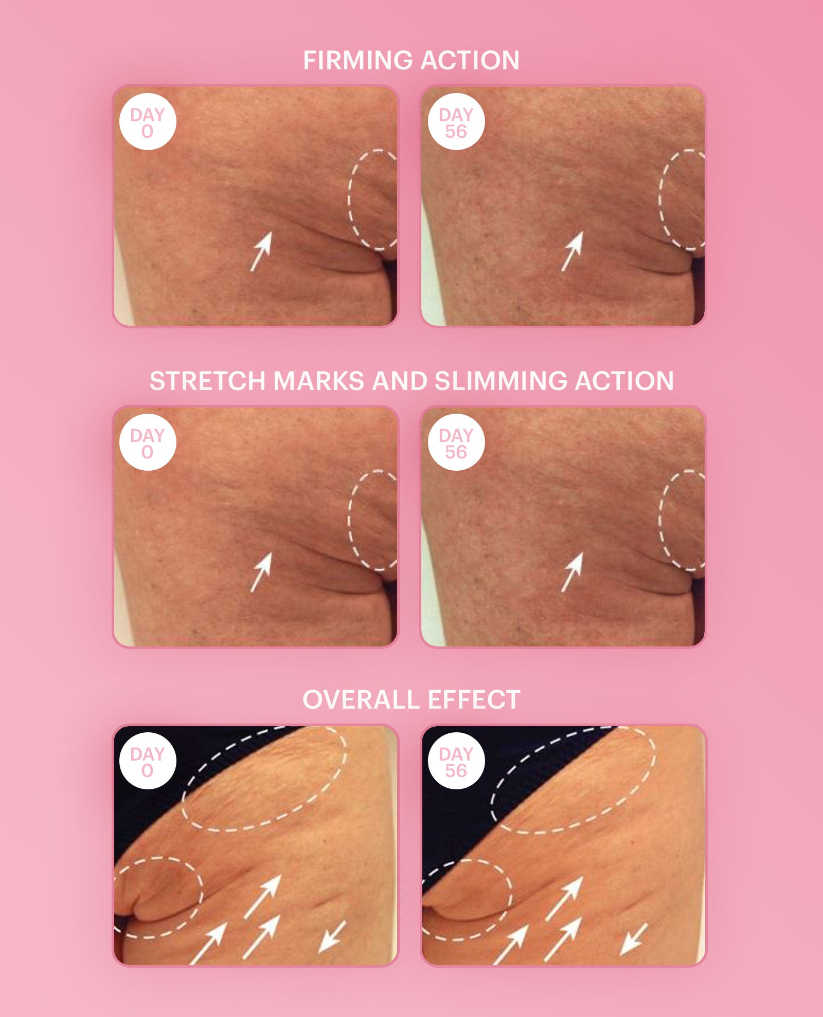 Firming Breast Lotion
