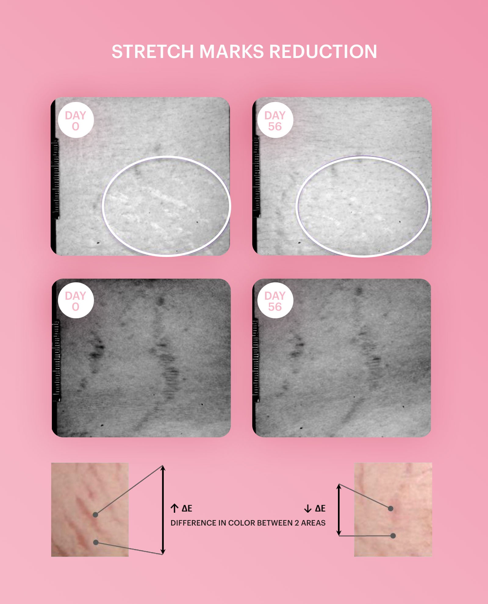 Firming Breast Lotion